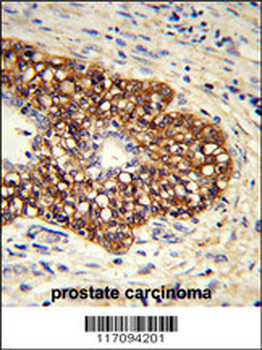 CYP8A1 Antibody (C-term)