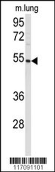 CYP8A1 Antibody (N-term)
