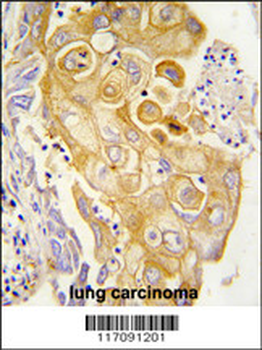 CYP8A1 Antibody (N-term)