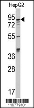 AAK1 Antibody (C-term)