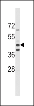 ALDH1A3 Antibody (Center)