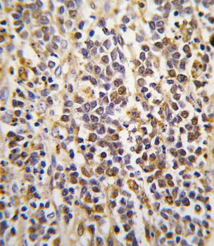ALDH1A3 Antibody (Center)