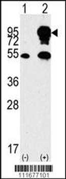 B-RAF Antibody (Center)
