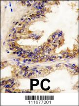 B-RAF Antibody (Center)