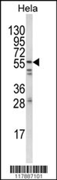 FYN Antibody (N-term)