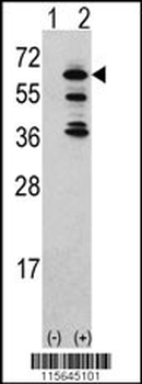 ACK1 Antibody (Center)