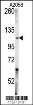 ABL1 Antibody (Center)