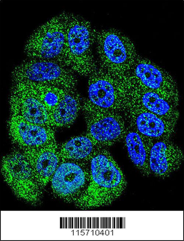 ABL1 Antibody (Center)