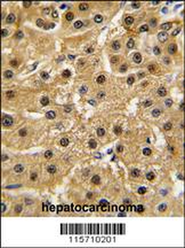 ABL1 Antibody (Center)