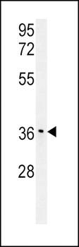 IGFBP3 (S183) antibody