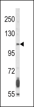FGFR2 Antibody