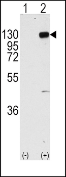 FGFR1 Antibody (Y766)