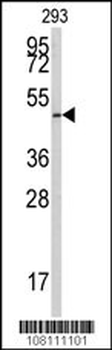E2F1 Antibody (S332)