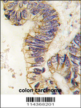 SRC1 Antibody (C-term)