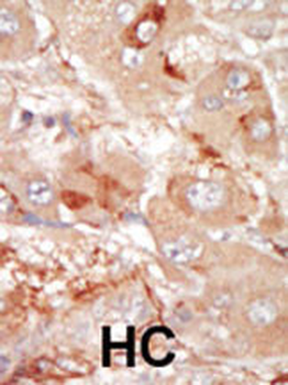 PRP4 Antibody (C-term)