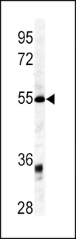 GDF6 Antibody (C-term)