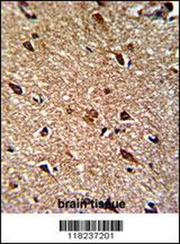 IDH1 Antibody (N-term)