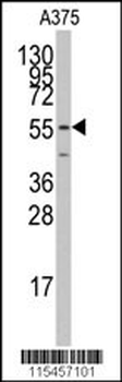 PTRF Antibody (C-term)