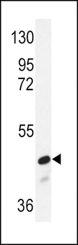SMAD2 Antibody