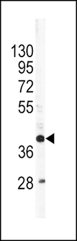 APOL1 Antibody (C-term)