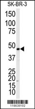 ADRB2 Antibody (T384)