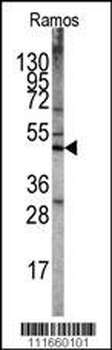 STK11 (LKB1) Antibody (N-term V34)