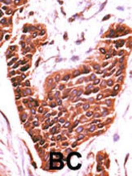 STK29 Antibody (C-term)