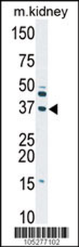 Deoxyguanosine Kinase (DGUOK) Antibody (N-term)