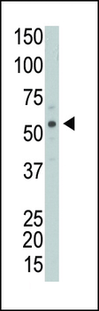 PICK1 (PRKCABP) Antibody (N-term)