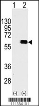 AKT2 Antibody (S474)