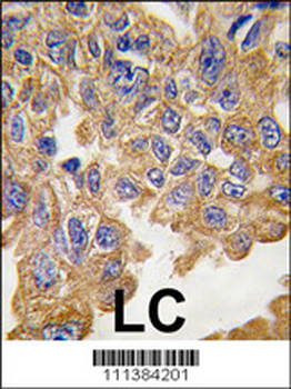 AKT2 Antibody (S474)