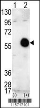 AKT2 Antibody (C-term)
