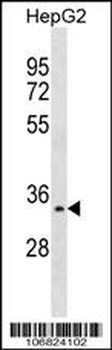 Aurora-C Antibody (N-term G11)