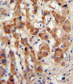 NAT2 Antibody (C-term)