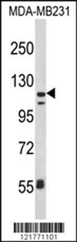 ITGAX Antibody (C-term)