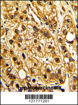 ITGAX Antibody (C-term)