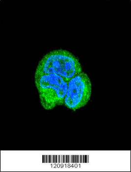 ASPA Antibody (N-term)
