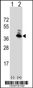 ASPA Antibody (N-term)