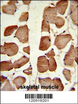 ASPA Antibody (N-term)