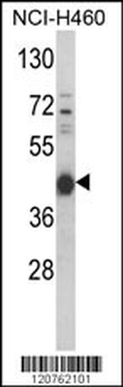 PRKACA Antibody (N-term K82)