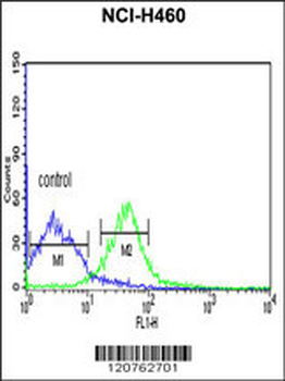 PRKACA Antibody (N-term K82)
