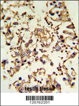 PRKACA Antibody (N-term K82)