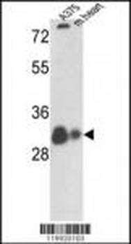 VDAC1 Antibody (N-term)
