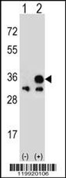 VDAC1 Antibody (N-term)