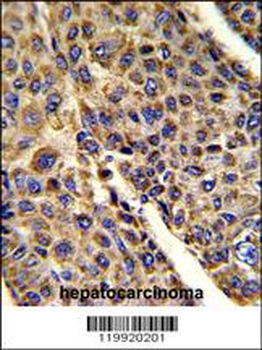 VDAC1 Antibody (N-term)