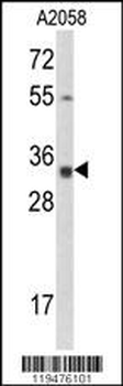 Calponin-3 Antibody (N-term)