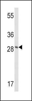 FXN Antibody (Center)