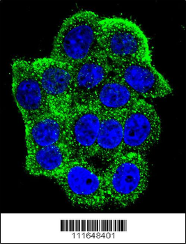 Hamartin (TSC1) Antibody (Center)