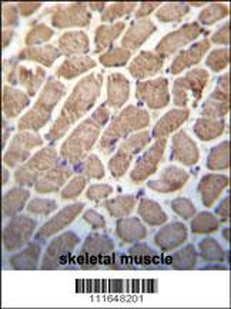 Hamartin (TSC1) Antibody (Center)