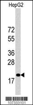 27Kip1 Antibody (C-term)